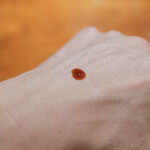 コントワール フー - 