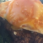 The Counter  - 目玉