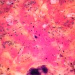 ピッツェリア ダ マッシモ - マリナーラのアップです（２０１１年５月）。