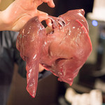 久遠の空 - 2018.2 肝臓